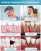 CAREDO Healing Teeth Crack Toothpaste The ONLY Toothpaste Repairing Cracked Teeth Enamel Cracks Cure Tooth Sensitivity Remove Pigment in Crack 100g 2 Counts As Mothers Day Gift