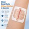 LotFancy Emergency Wound Closure Strips Kit 4 Sterile ZipStyle Closures