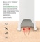 Bug Bite Thing Suction Tool Bug Bites and BeeWasp Stings Natural Insect Bite Relief Chemical Free White