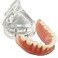 Smile1000 Dental Model Overdenture Inferior 4 Implants Demo for Teaching and Studying