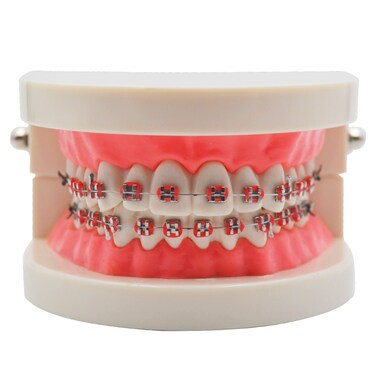 THModel Standard Tooth Teaching Mallocclusion Orthodontic Teeth Model with Brackets Archwire Buccal Tube Tool