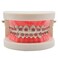 THModel Standard Tooth Teaching Mallocclusion Orthodontic Teeth Model with Brackets Archwire Buccal Tube Tool
