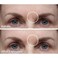 Dermaflage Scar Filler Refill Applicator