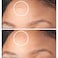 Dermaflage Scar Filler Refill Applicator