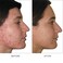jane iredale Advanced Nutrition Programme Skin Accumax Supplement distributed by jane iredale 60day supply