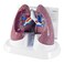 GPI Anatomicals Lung Model Set with Pathologies