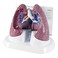 GPI Anatomicals Lung Model Set with Pathologies