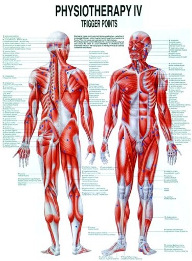 Anatomical Worldwide Trigger Points Laminated Chart