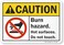 SmartSignCaution - Burn Hazard, Hot Surfaces, Do Not Touch Label7" x 10" Laminated Vinyl