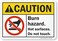 SmartSignCaution - Burn Hazard, Hot Surfaces, Do Not Touch Label7" x 10" Laminated Vinyl