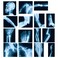 Sayglossy 15 Pcs Broken Bones x Ray Set Human x Rays Black and Blue Skeleton Pretend Xrays for Kids
