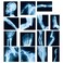 Sayglossy 15 Pcs Broken Bones x Ray Set Human x Rays Black and Blue Skeleton Pretend Xrays for Kids