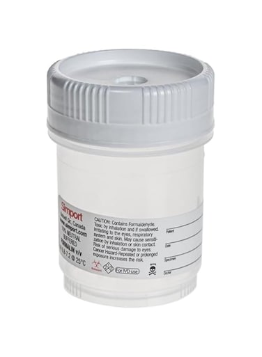King Mariot Medical Equipments HistoTainer II Prefilled Specimen Container   120ml Capacity   10% Formalin Solution   Leak-Resistant Seal   Durable Polypropylene Construction