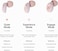 Loop Switch Earplugs &ndash; Multi-Mode Noise-Reducing Earplugs   Adjustable Passive Hearing Protection for Focus, Travel, Concerts, Socializing, Sports Events &amp; Noise Sensitivity   Reusable Ear Protection ROSE