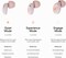 Loop Switch Earplugs &ndash; Multi-Mode Noise-Reducing Earplugs   Adjustable Passive Hearing Protection for Focus, Travel, Concerts, Socializing, Sports Events &amp; Noise Sensitivity   Reusable Ear Protection
