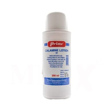 Prime Calamine Lotion 200ml