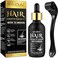 5% Minoxidil Hair Growth Serum Kit With Derma Roller,Minoxidil For Men and Women Hair Beard,2.02 oz Biotin Regrowth Serum Treatment For Getting Thicker Healthier Hair