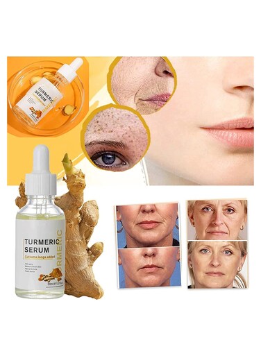 Turmeric Serum for Dark Spots 1 Fl Oz &ndash; Dark Spot Corrector for Face &amp; Body, Reduces Hyperpigmentation, Age Spots &amp; Sun Spots, Improves Skin Tone, Suitable
