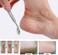 Foot Scraper Callus Shaver - Professional Pedicure Foot File with Stainless Steel Blades - Hard Skin Remover for Smooth Feet - Foot Rasp Kit