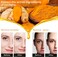 Turmeric Dark Spot Corrector Serum &ndash; Natural Turmeric Oil for Acne, Dark Spots, Hyperpigmentation, Fine Lines, and Wrinkles &ndash; Smooth &amp; Clear Skin Treatment
