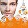 Turmeric Dark Spot Corrector Serum &ndash; Natural Turmeric Oil for Acne, Dark Spots, Hyperpigmentation, Fine Lines, and Wrinkles &ndash; Smooth &amp; Clear Skin Treatment
