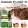 2PCS Rosemary Oil for Hair Growth &ndash; 100% Pure Essential Oil for Hair Loss Treatment &amp; Scalp Care &ndash; Natural Oil for Thicker, Stronger Hair &amp; Skin Nourishment &ndash; 30ml Each
