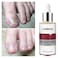 Nail Repair Essence Serum 15ml &ndash; Fungus Treatment &amp; Nail Strengthening for Onychomycosis &ndash; Fast-Acting Nail Repair &amp; Removal Solution