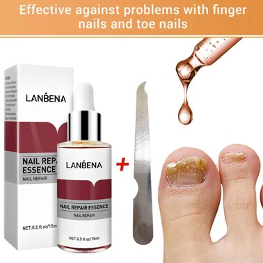 Nail Repair Essence Serum 15ml &ndash; Fungus Treatment &amp; Nail Strengthening for Onychomycosis &ndash; Fast-Acting Nail Repair &amp; Removal Solution