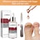 Nail Repair Essence Serum 15ml &ndash; Fungus Treatment &amp; Nail Strengthening for Onychomycosis &ndash; Fast-Acting Nail Repair &amp; Removal Solution