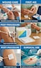 Premium Non-Woven Gauze Swabs - 10cm x 10cm, 4-Ply, High Absorbency Sterile Feel (100 PCS) &ndash; Ideal for Wound Care, First Aid &amp; Clinical Use