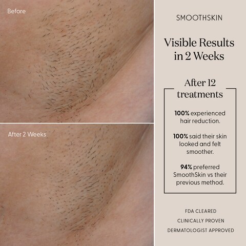 SmoothSkin Pure Adapt - Advanced IPL Hair Removal Device - Green