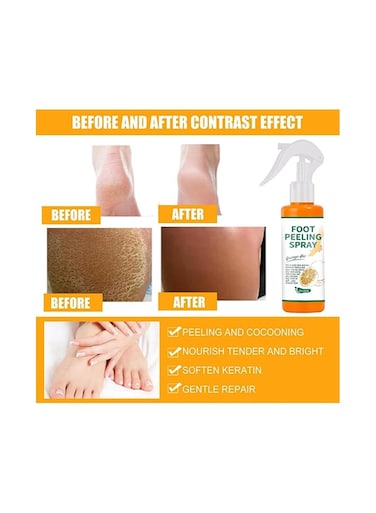 Foot Peeling Spray Orange Oil Foot Peeling Spray That Remove Dead Skin Hydrating Nourish Pedicure Dead Skin Exfoliator for Cracked Rough Heels Dry Toe Skin and Calluses