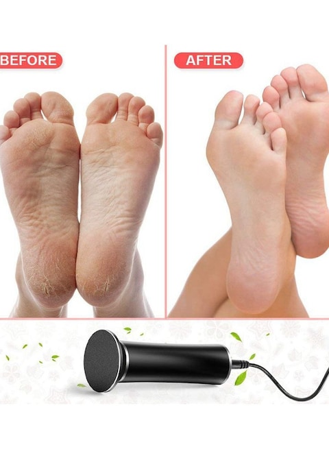 フットケア Electric Callus Remover Amazon.com : Electric Callus Remover for Feet with Vacuum