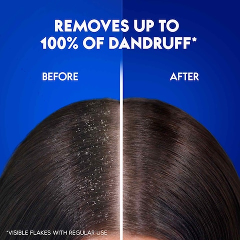 Head &amp; Shoulders Classic Clean Anti-Dandruff Shampoo for Normal Hair 200ml