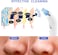 Vacuum Blackhead Remover, Face Suction Pore Vacuum Cleaner For Acne, Oil, Dirt, Dead Skin, 4 Suction Head Facial Pore Vacuum Kit