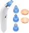 Vacuum Blackhead Remover, Face Suction Pore Vacuum Cleaner For Acne, Oil, Dirt, Dead Skin, 4 Suction Head Facial Pore Vacuum Kit