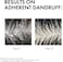 Vichy Dercos Anti Dandruff Shampoo For Dry Hair 200ml