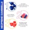 ULTIMAX Deluxe Vinyl Dumbbell Set &ndash; 2KG Pair   Non-Slip Hand Weights for Home &amp; Gym Workouts