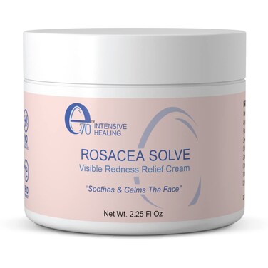 Rosacea Solve - Redness Relief Cream - Face Moisturizer For Rosacea &amp; Acne Prone Skin - Sensitive Skin Care With Organic Ingredients, Almond Oil, Licorice &amp; Chamomile Extracts - No Parabens