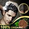 2 Pcs Natural Darkening Shampoo Bar Set &ndash; Organic Hair Darkening Soap for Gray &amp; White Hair &ndash; Herbal Repair &amp; Moisturizing Shampoo Bar for Natural Color Restoration &ndash; Unisex Solid Hair Care