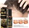 Professional Hair Growth Oil for Thick &amp; Healthy Hair &ndash; Natural Scalp Nourishment, Strengthening Formula for Hair Fall Control &amp; Hair Regrowth