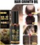Professional Hair Growth Oil for Thick &amp; Healthy Hair &ndash; Natural Scalp Nourishment, Strengthening Formula for Hair Fall Control &amp; Hair Regrowth