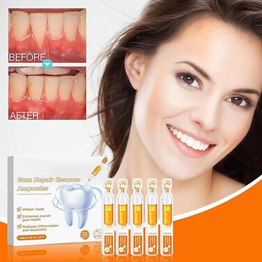 Gum Repair Treatment Ampoules for Oral Care &ndash; Tartar Removal, Teeth Cleaning &amp; Gum Protection, Deep Oral Hygiene Essence