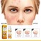 Acne Treatment Cream for Pimples &amp; Blemishes &ndash; Gentle Face Care for Clear, Bright Skin, Oil Control &amp; Skin Nourishing Formula