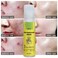 Organic Facial Acne Serum for Pimples &amp; Dark Spots &ndash; Soothing Skin Care, Scar Fading, Oil Control &amp; Clear Skin Treatment