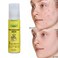 Organic Facial Acne Serum for Pimples &amp; Dark Spots &ndash; Soothing Skin Care, Scar Fading, Oil Control &amp; Clear Skin Treatment