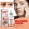 Milia Removal Face Serum &ndash; Skin Smoothing Spot Treatment Serum for Face Care, Helps Improve Bumpy Skin Texture &amp; Clearer Looking Skin