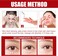 Milia Removal Face Serum &ndash; Skin Smoothing Spot Treatment Serum for Face Care, Helps Improve Bumpy Skin Texture &amp; Clearer Looking Skin