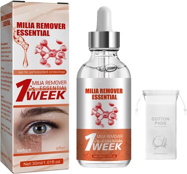 Milia Removal Face Serum &ndash; Skin Smoothing Spot Treatment Serum for Face Care, Helps Improve Bumpy Skin Texture &amp; Clearer Looking Skin
