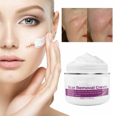 Advanced Scar Removal Cream &ndash; Skin Smoothing Care for Old &amp; New Scars, Stretch Marks, Acne &amp; Injury Marks for Face &amp; Body